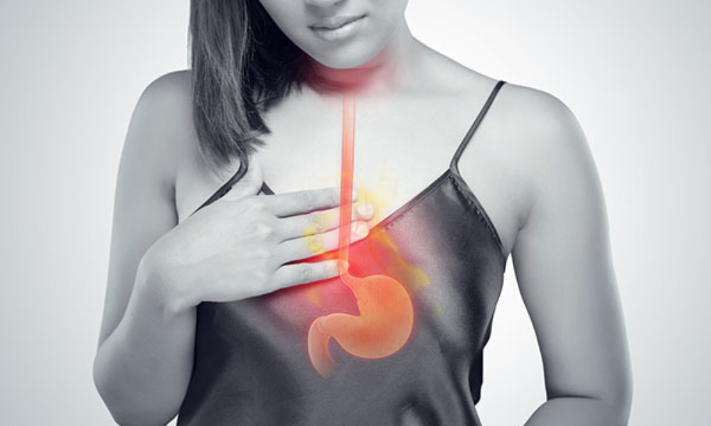 Acid Reflux vs. GERD: What's the Difference?