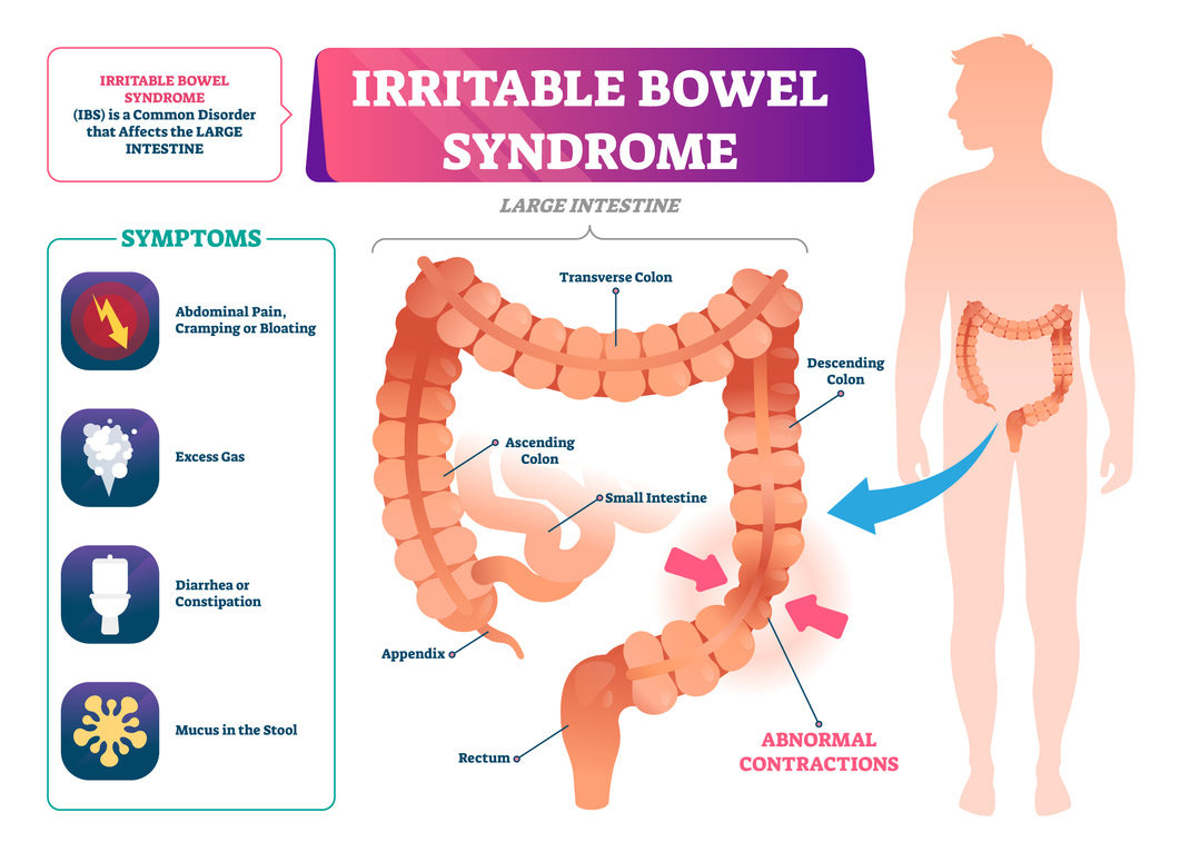 Pan integral colon irritable